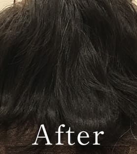 50代女性 発毛施術アフター