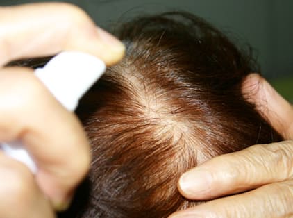 幹細胞培養液写真