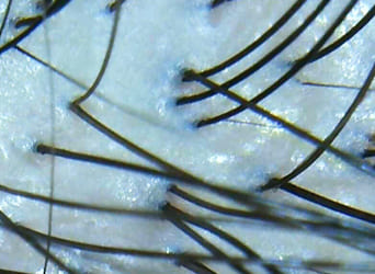 頭皮の状態チェック