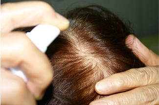 幹細胞培養液写真